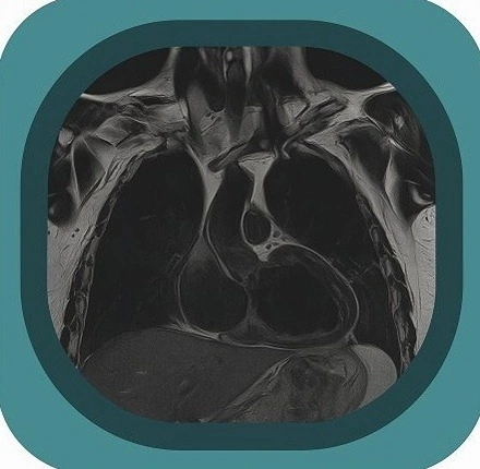 MRI chest anatomy icon